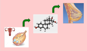Causas del cáncer de mama