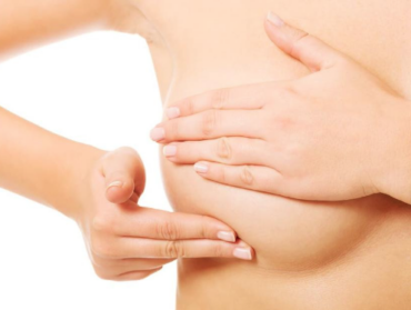 Síntomas del cáncer de mama